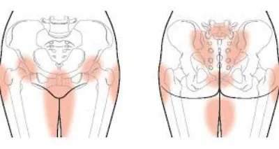 Pelvic-compression-wear-in-pregnancy-img-2